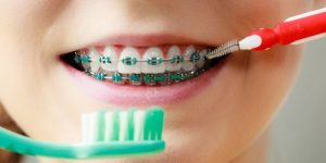 ویژگی مسواک ارتودنسی